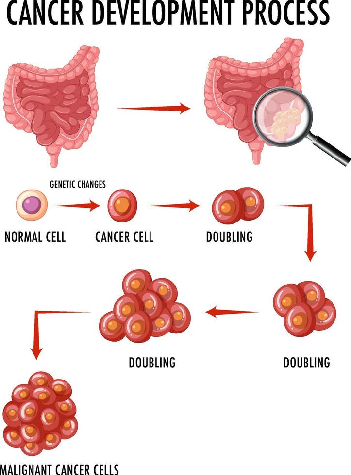 Diagram showing cancer development process vector