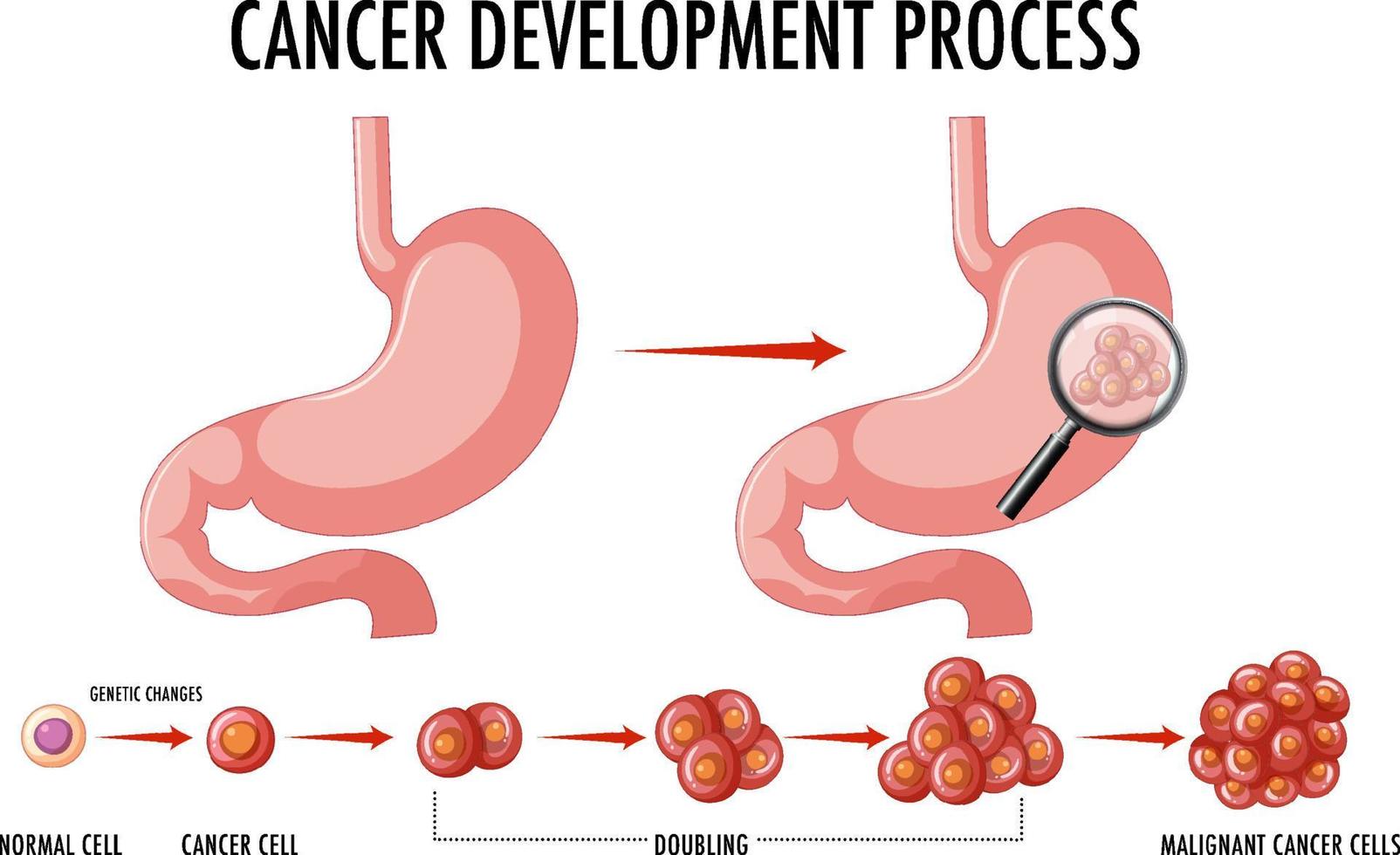 Diagram showing cancer development process vector
