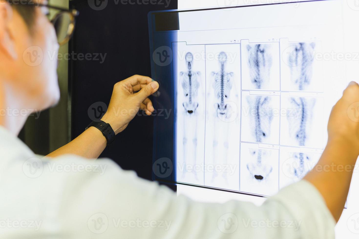 Side view of medical doctor looking at human x-ray. photo