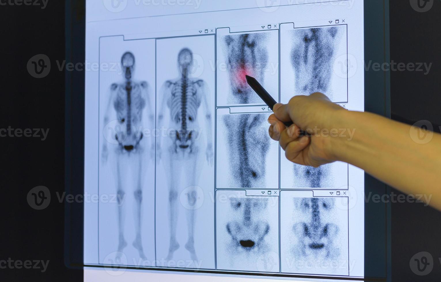 Doctor hand pointing on skeleton x-ray film. photo