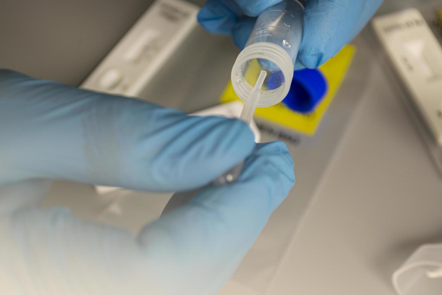 COVID-19 rapid test performed in hospital lab with background of viral tests photo