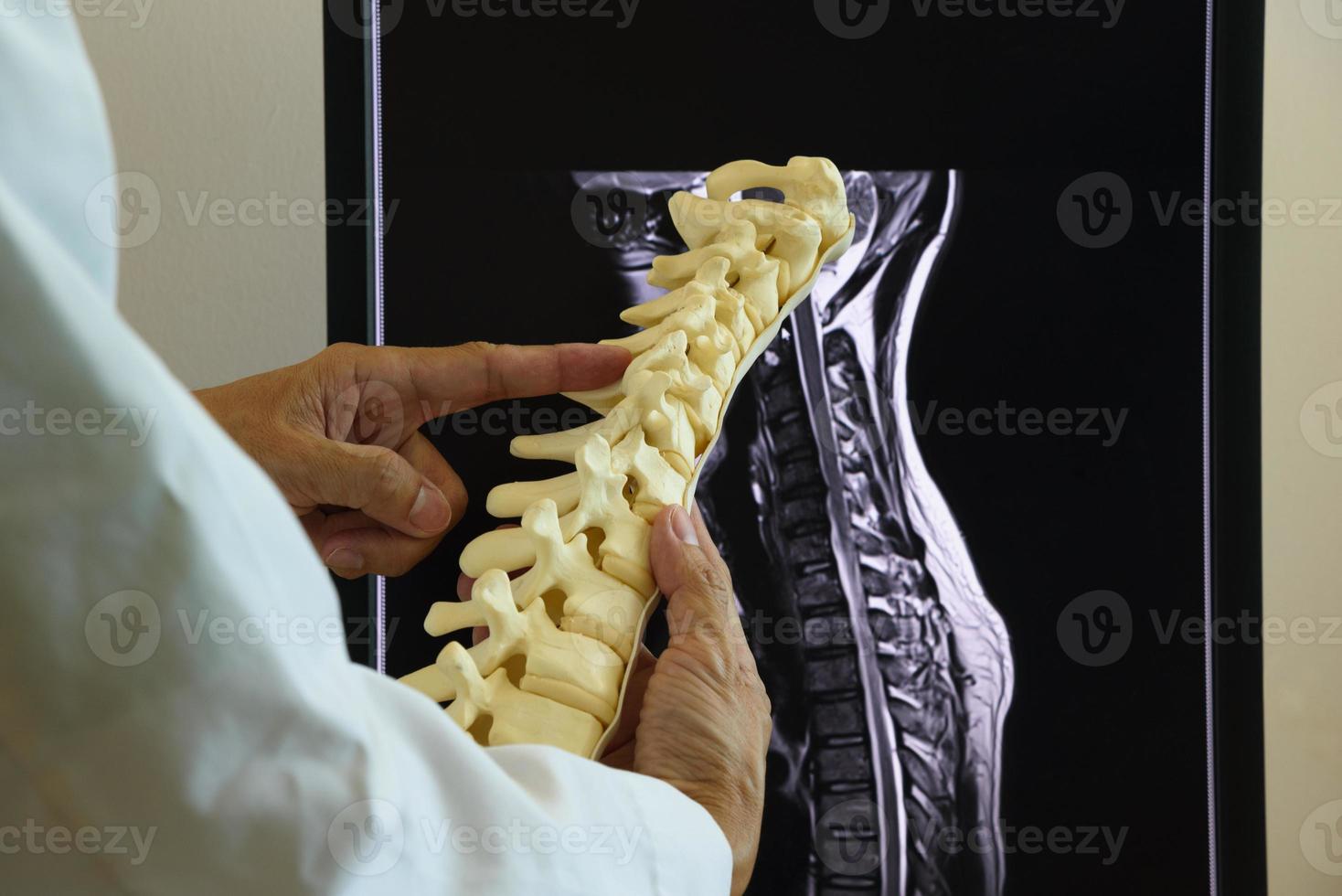 médico que sostiene el modelo de la columna cervical y la resonancia magnética en el fondo foto