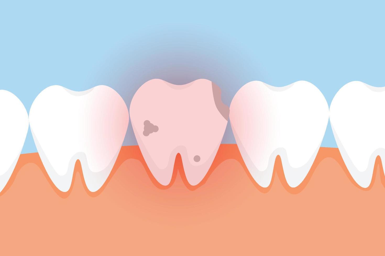 dolor de diente malo con vector de efecto de brillo de peligro rojo. un vector de diente muerto con un efecto de brillo rojo. un diente muerto con caries vector de concepto de elementos infográficos dentales. un diente con caries duele.