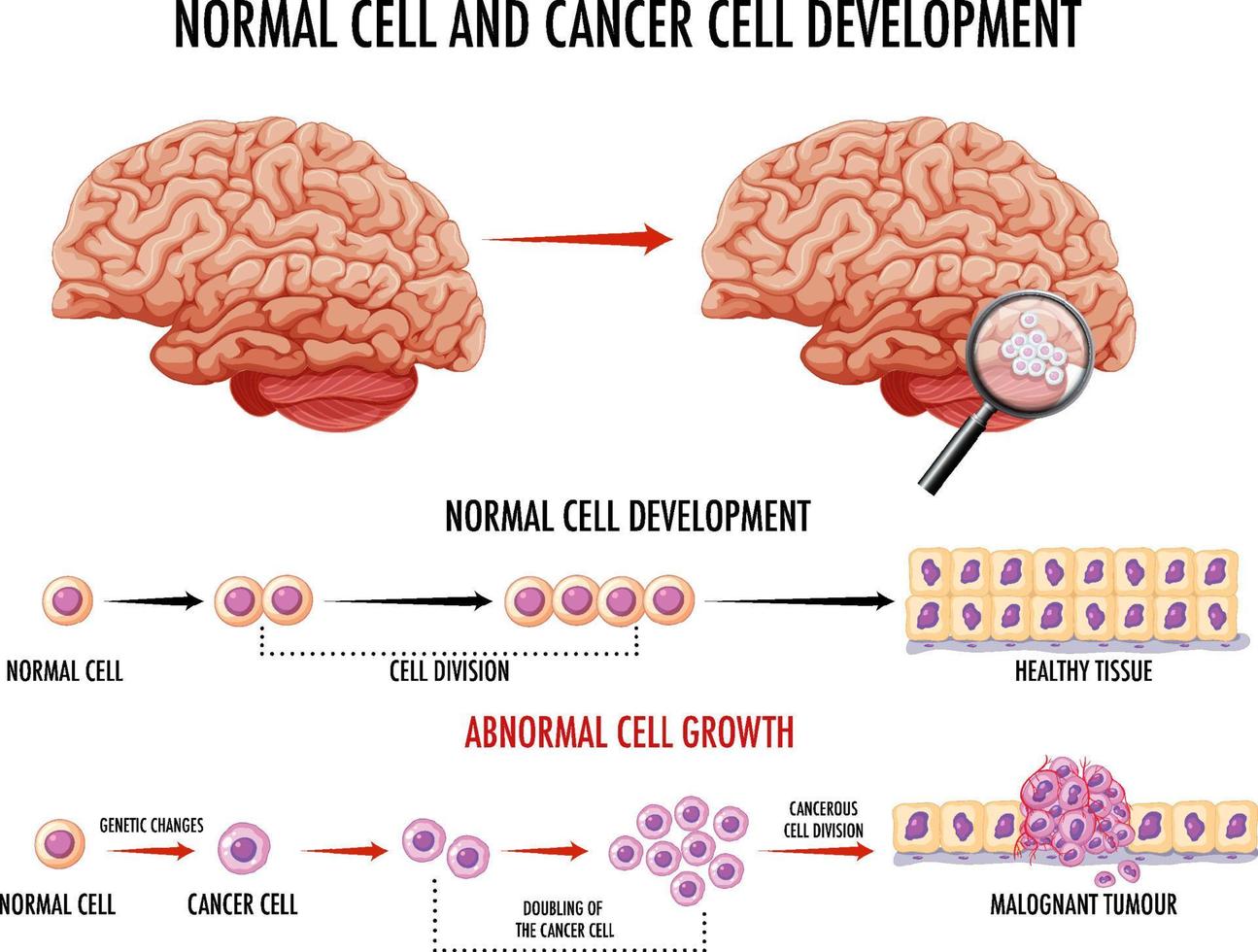 Diagram showing normal and cancer cells in human vector