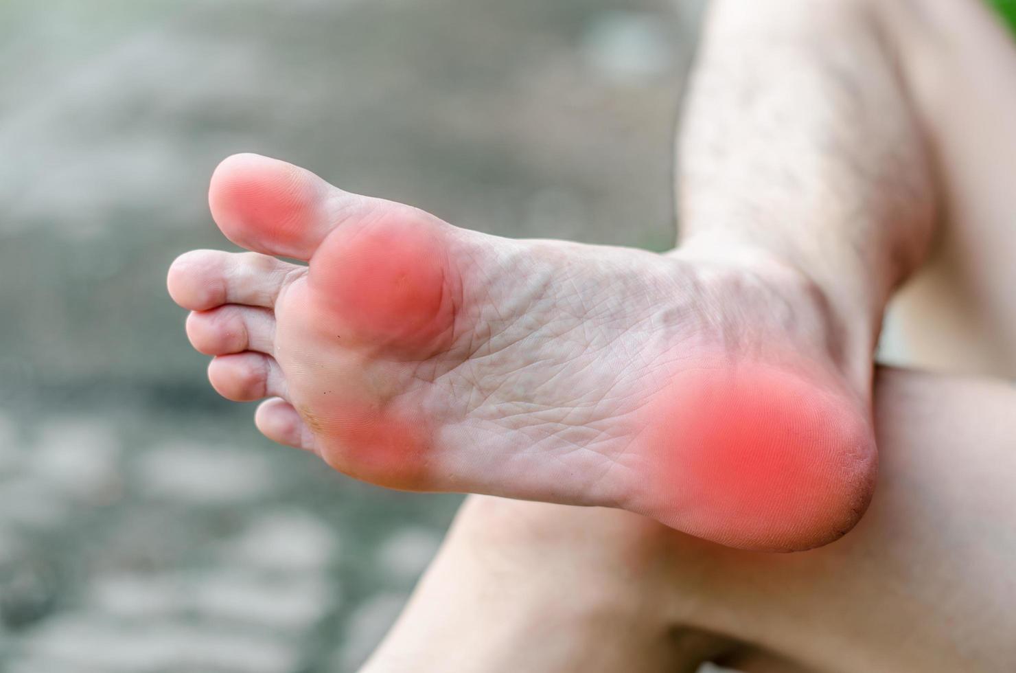 Male foot pain, Man's problem concept photo