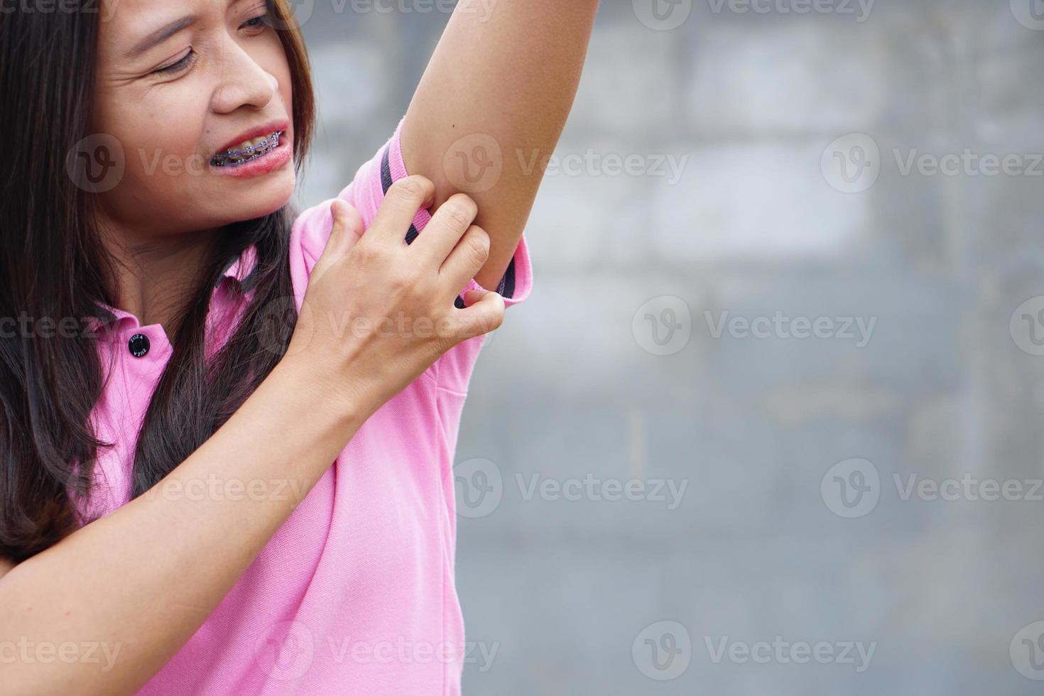 Asian women have armpit congestion. photo