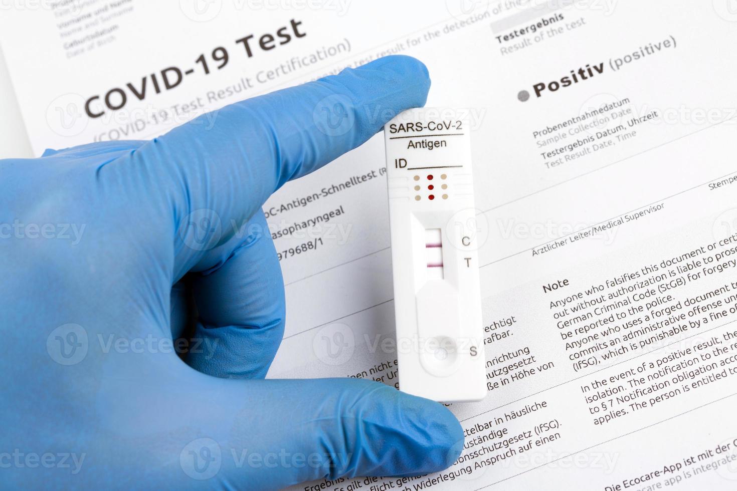 Positive test result by using rapid test device for COVID-19. photo