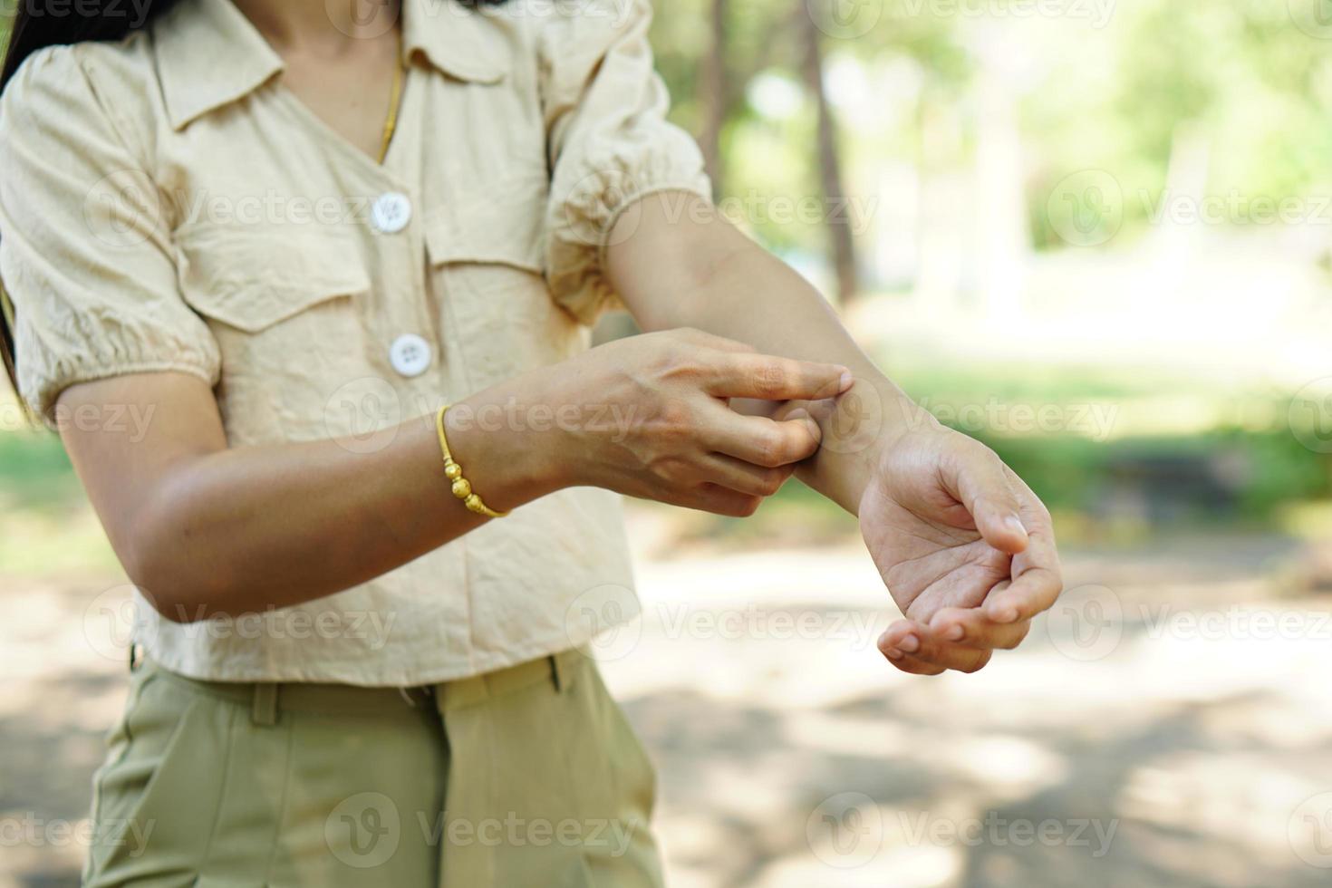 mujer rascándose el brazo por picazón foto