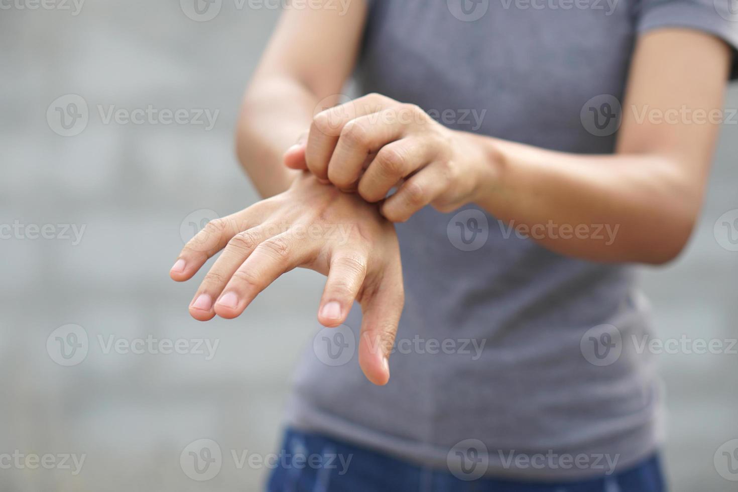 mujer rascándose el brazo por picazón en un fondo gris claro. la causa de la picazón en la piel incluye picaduras de insectos concepto de cuidado de la salud de la piel. foto