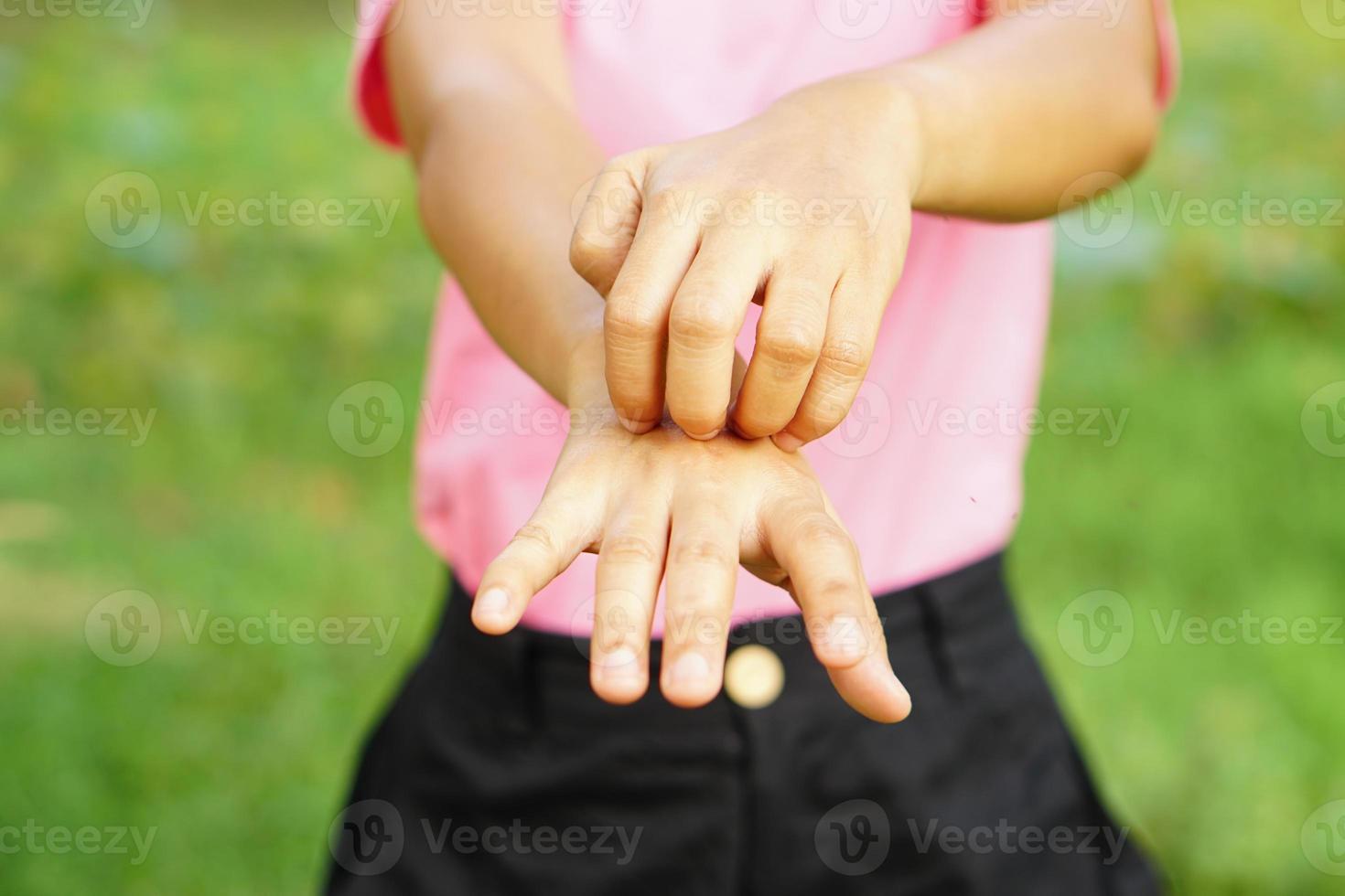 Woman scratching arm from itching on light gray background. Cause of itchy skin include insect bitesConcept of health care skin. photo