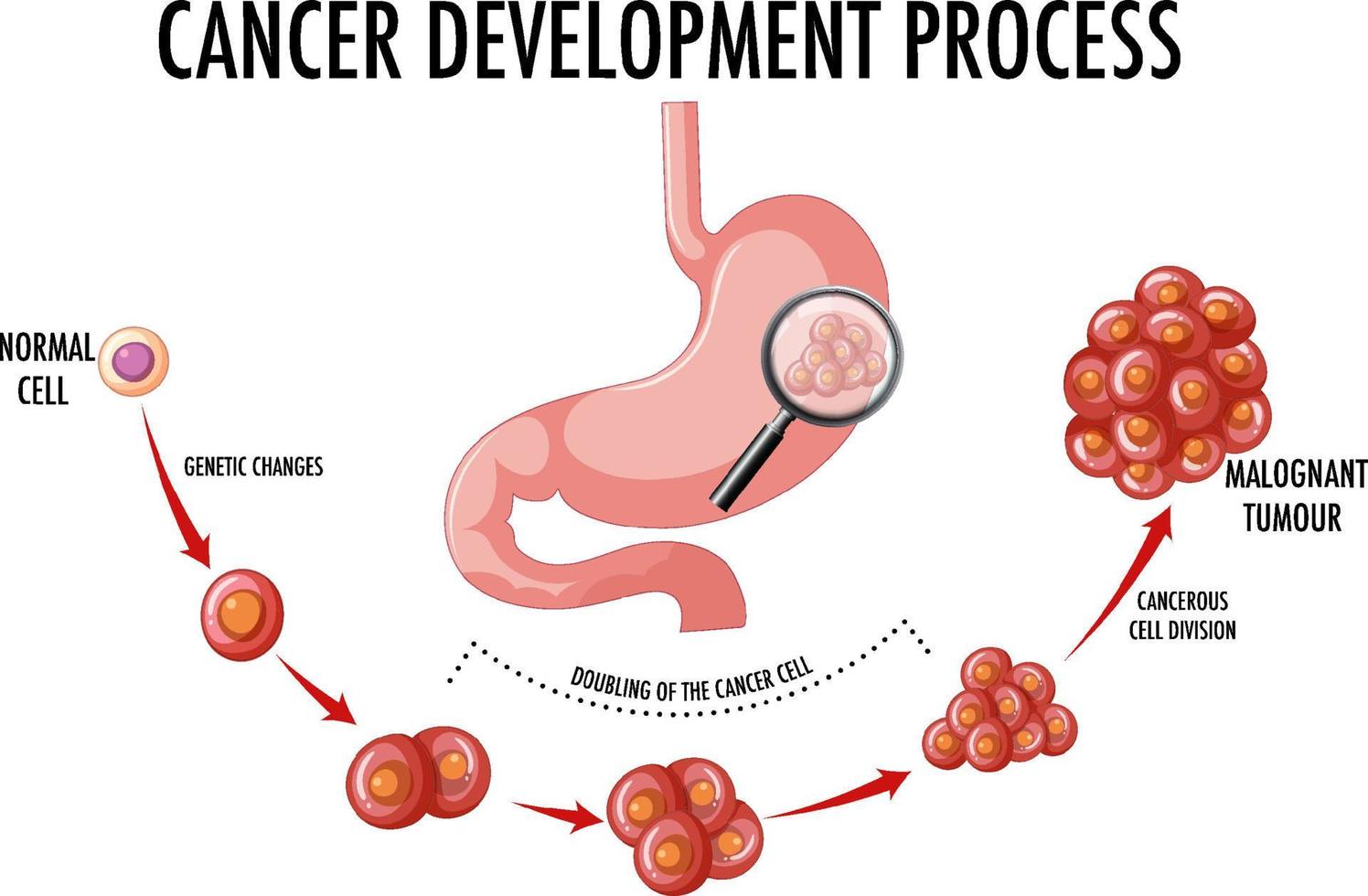 Diagram showing cancer development process vector