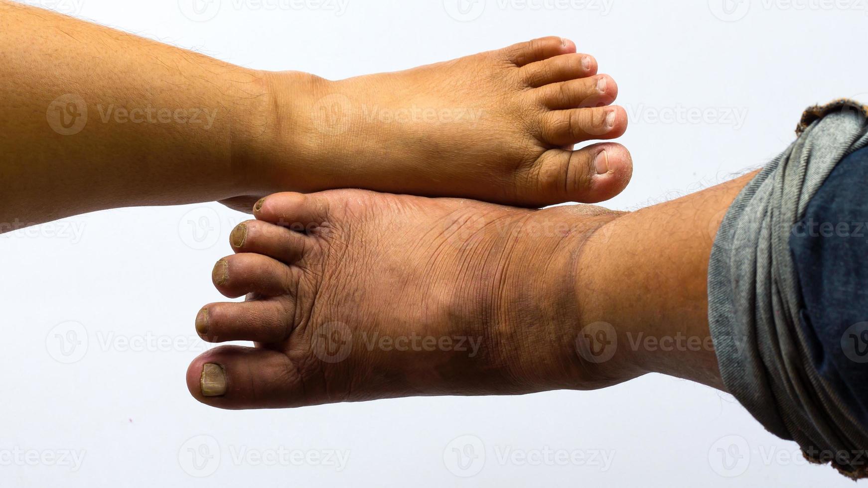 Above the feet of obese people. photo