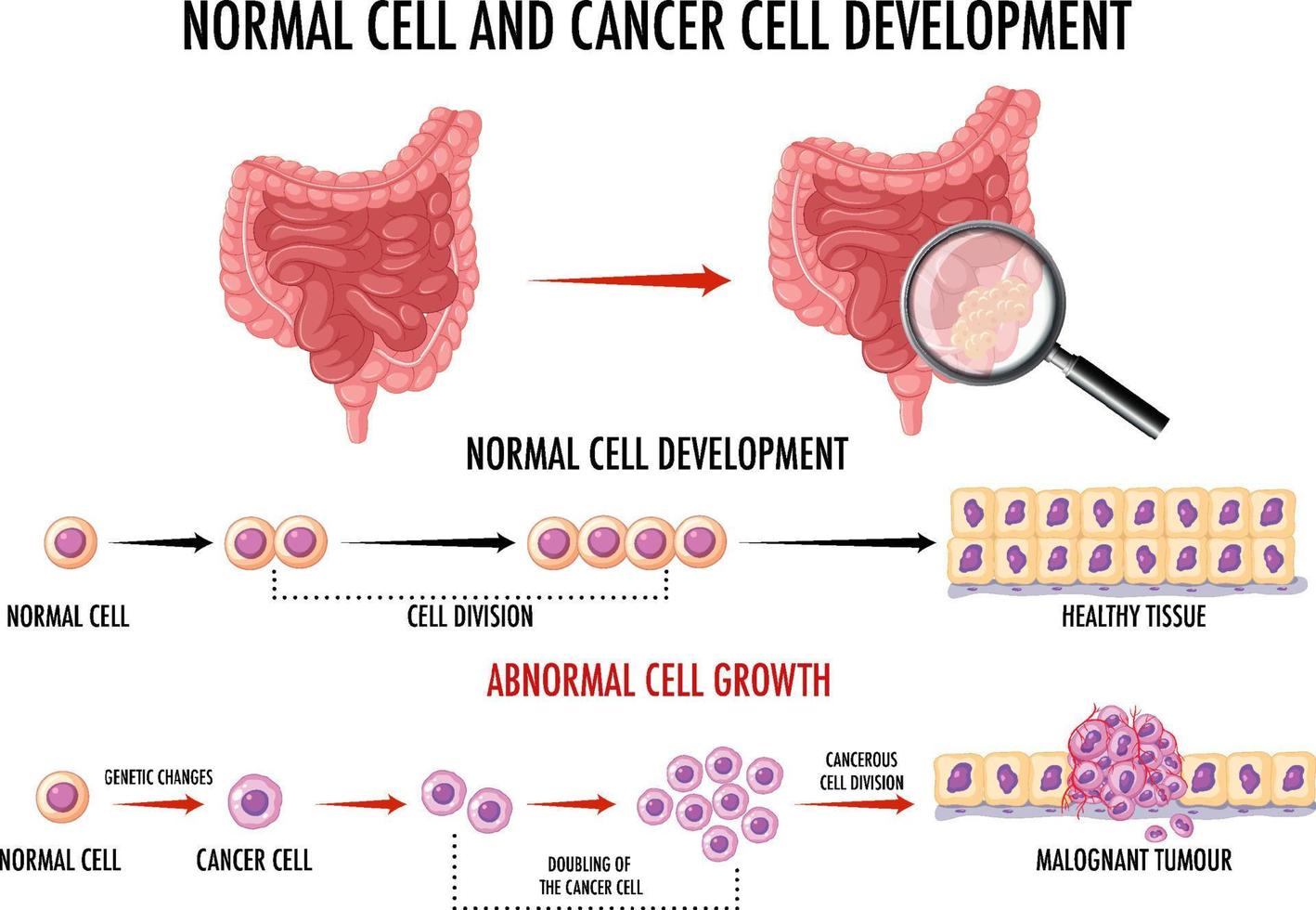 Diagram showing normal and cancer cells vector
