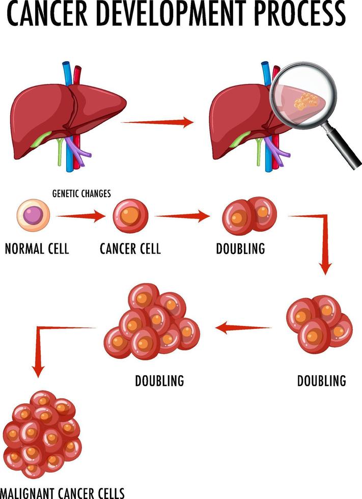 Diagram showing cancer development process vector