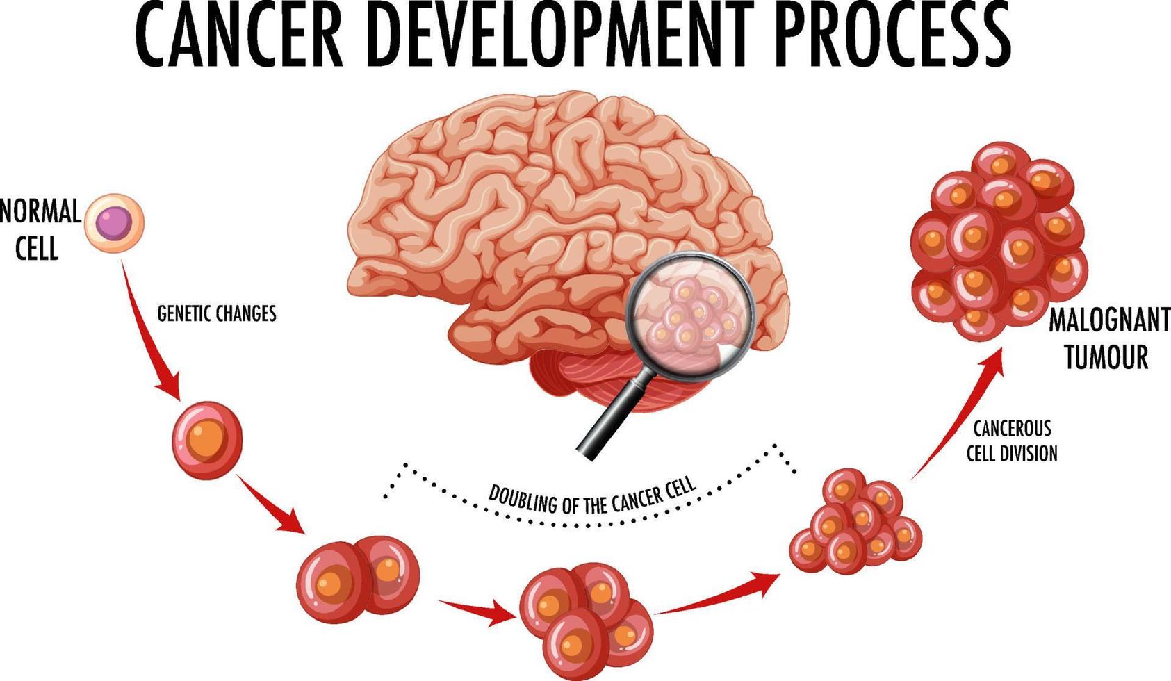 Diagram showing cancer development process vector