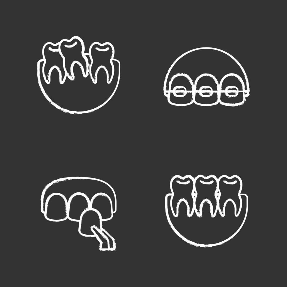 Dentistry chalk icons set. Stomatology. Crooked and healthy teeth, dental braces, veneer. Isolated vector chalkboard illustrations