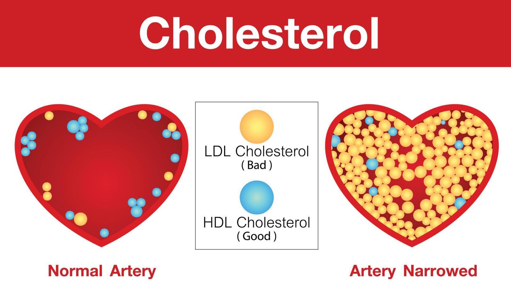 colesterol en arteria, riesgo para la salud, diseño vectorial. vector