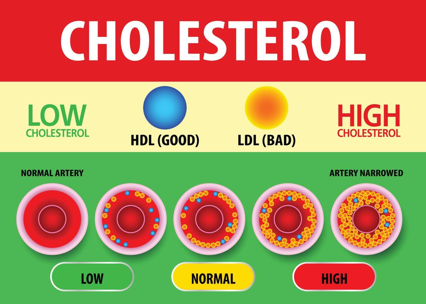 Cholesterol in artery, health risk , vector design