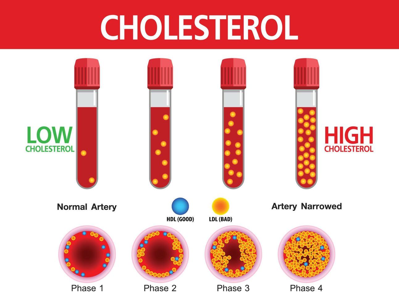 colesterol en la arteria, riesgo para la salud, diseño vectorial vector