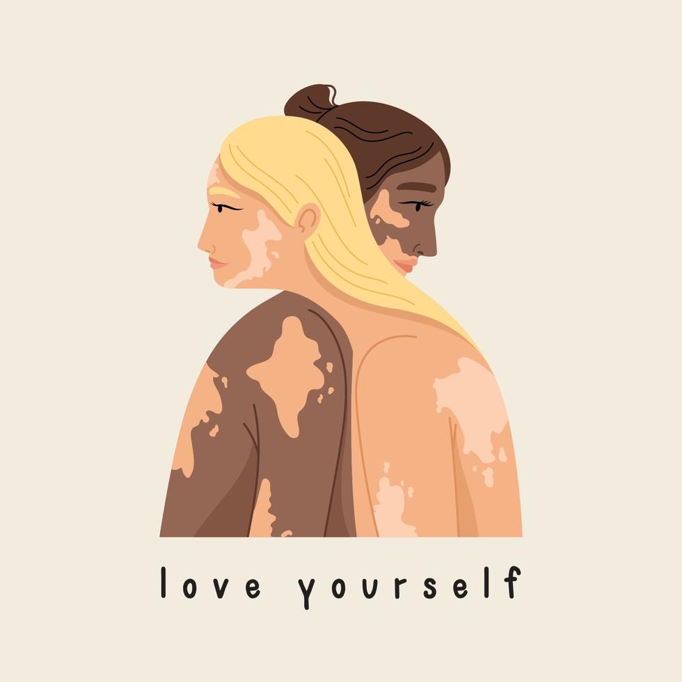 Two women with vitiligo of different nationalities standing together. World vitiligo day concept. Different skin color female characters vector