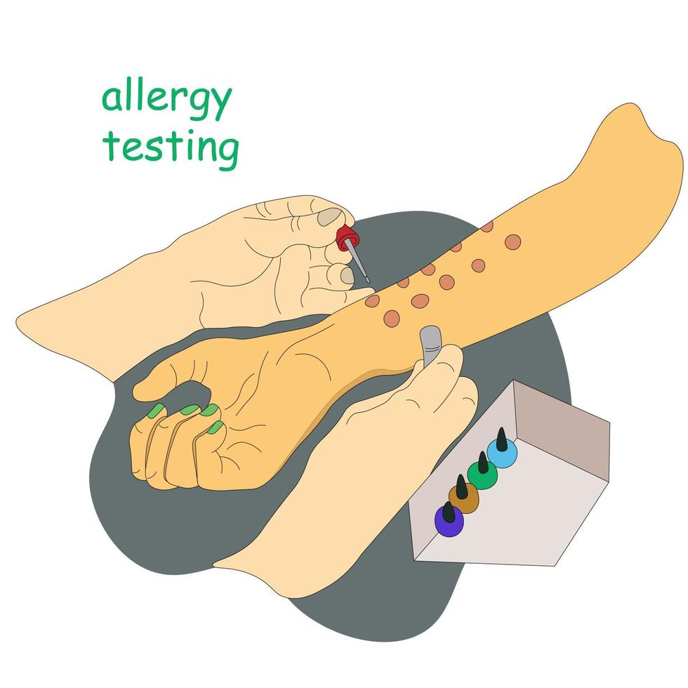 Allergy test. The doctor holds pipette in his hand to study allergic reactions. Laboratory analysis. patient with an allergic reaction. Vector illustration for medical websites advertising medicines.