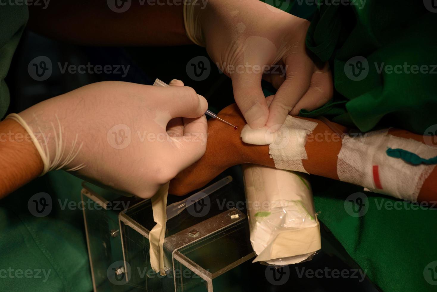 el doctor perforó la muñeca del paciente para la línea arterial foto