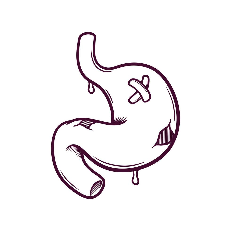 unhealthy human stomach hand drawn doodle illustration vector