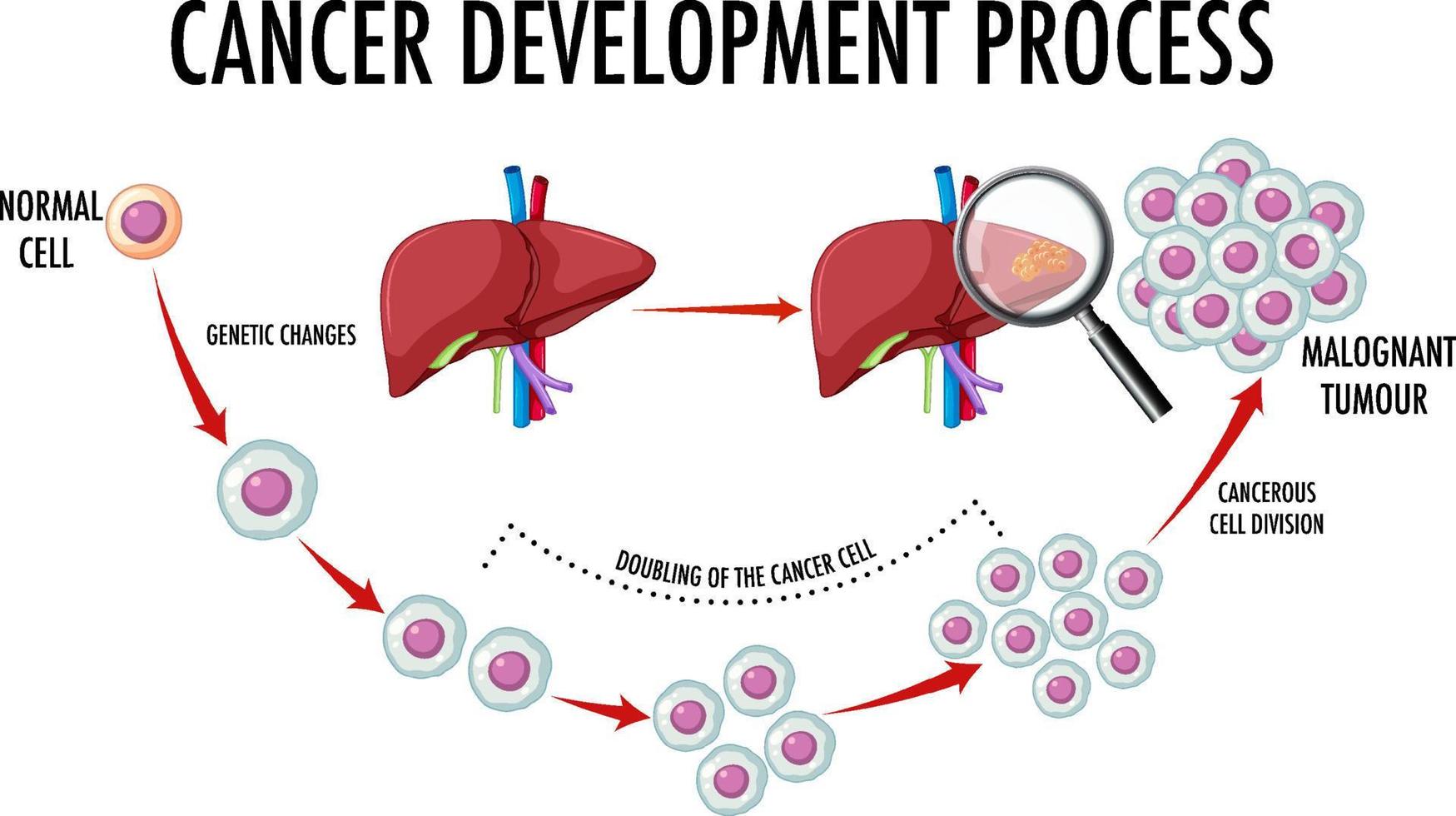 Diagram showing cancer development process vector