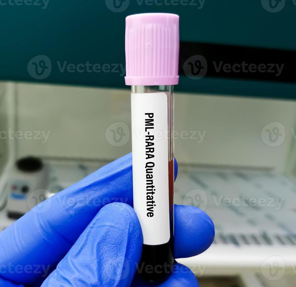 Prueba de sangre cuantitativa store