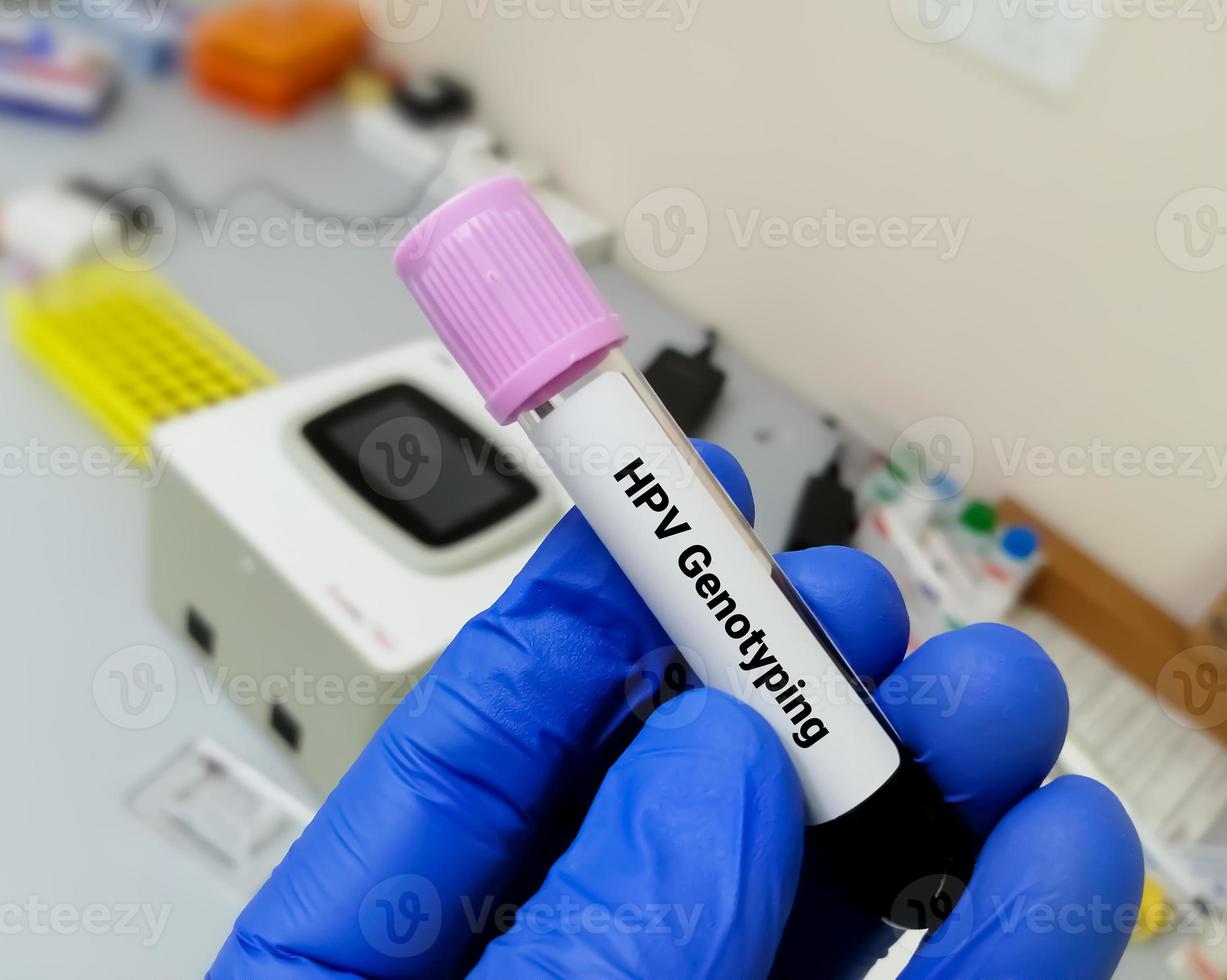 Blood sample for Human papillomavirus or HPV genotyping testing in PCR laboratory photo