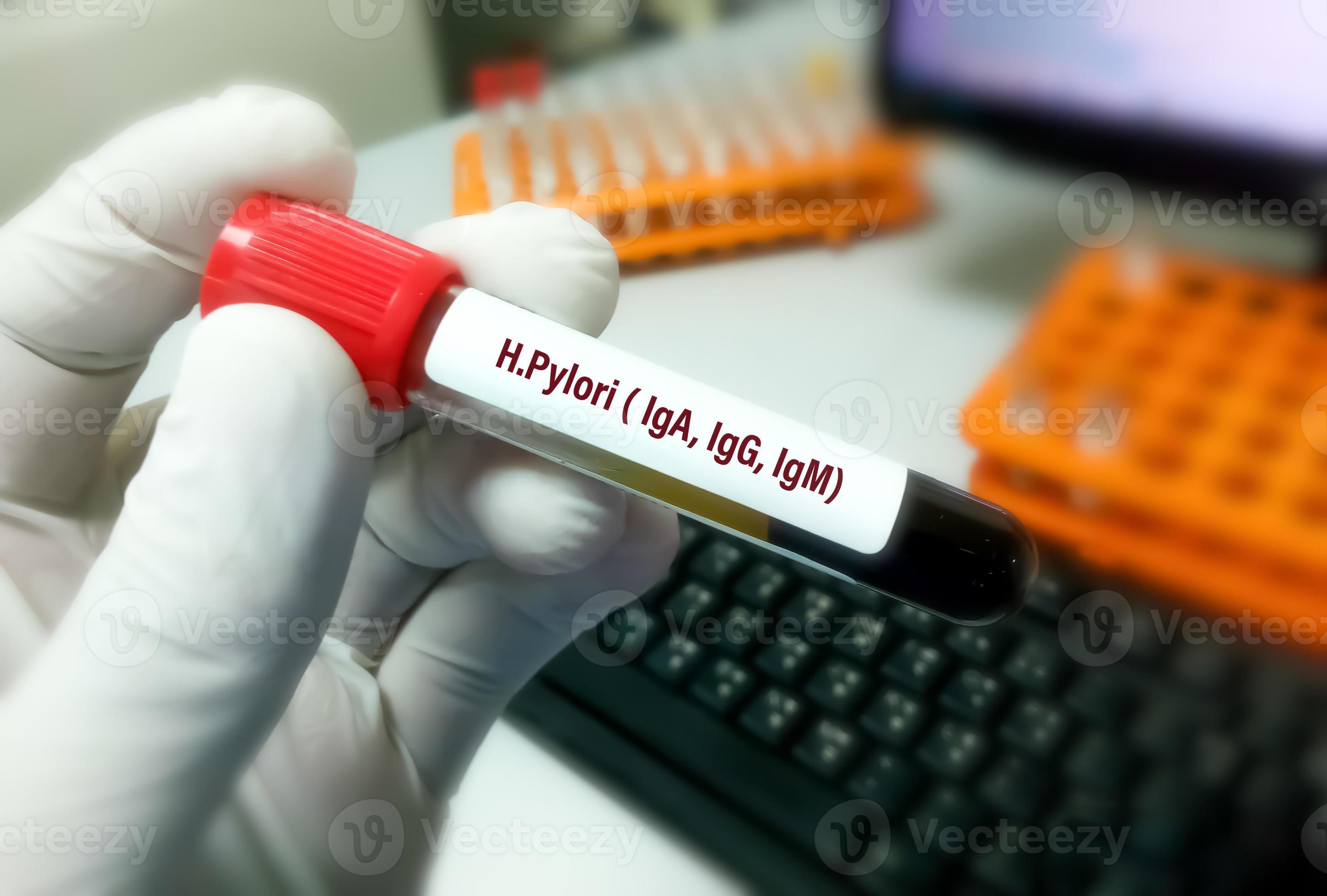 muestra de sangre para h. iga pylori, prueba igg e igm, helicobacter