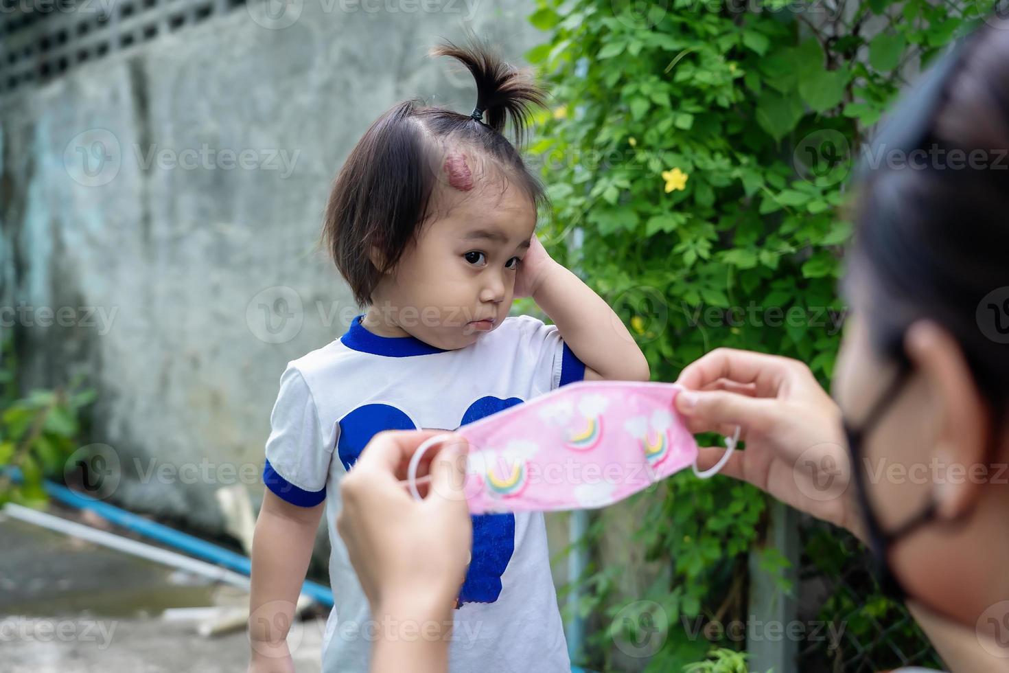 Adorable little child girl with big capillary strawberry hemangiomas red birthmark on head refuses to wear medical face mask that the mother or guardian are trying to put on face. Health care concept photo