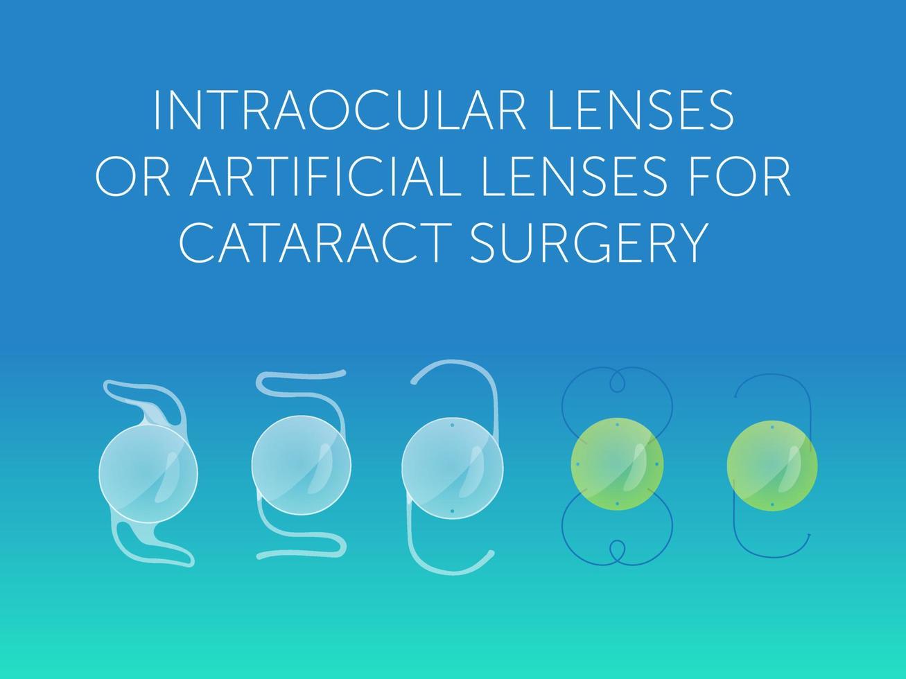 lentes intraoculares o lentes artificiales para cirugía de cataratas vector