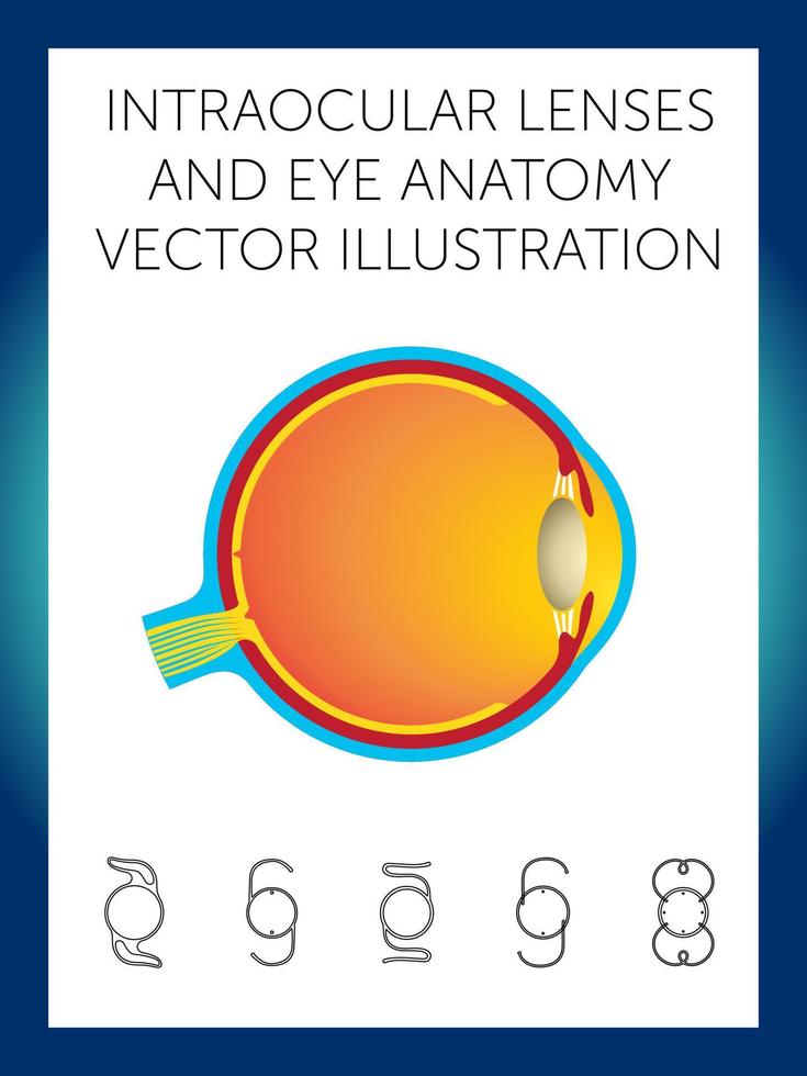 intraocular lenses and eye anatomy vector illustration