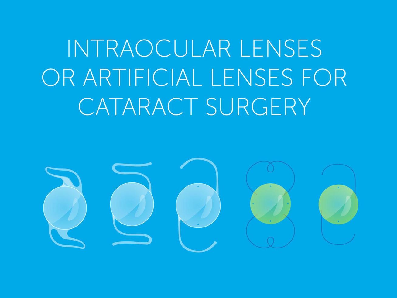 lentes intraoculares o lentes artificiales para cirugía de cataratas vector