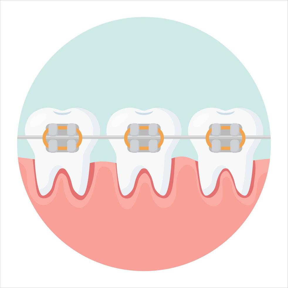 Teeth icon with braces on a blue background. Orthodontic treatment, teeth straightening with braces. vector