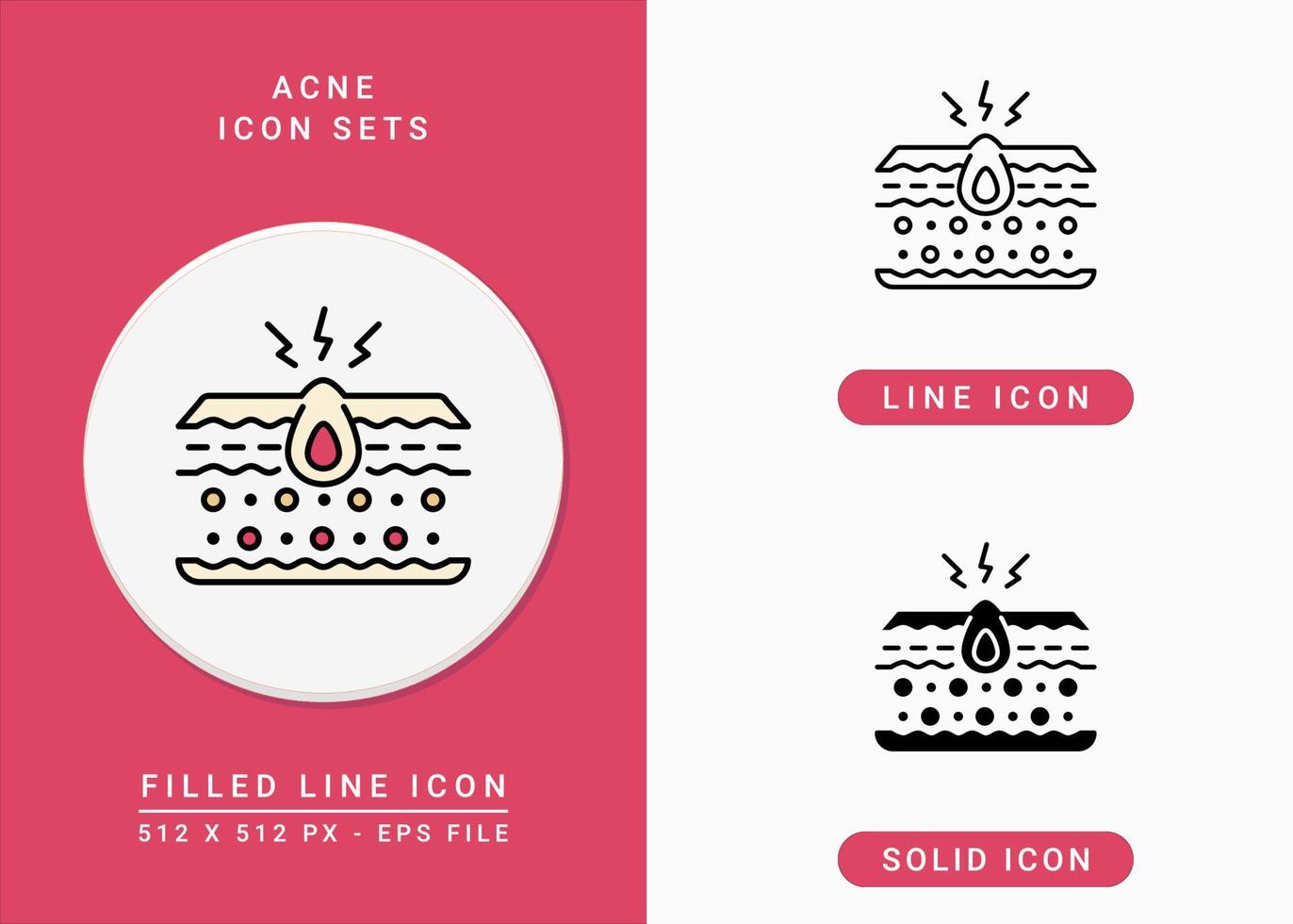 Acne icons set vector illustration with solid icon line style. Layer pore inflammation concept. Editable stroke icon on isolated background for web design, infographic and UI mobile app.