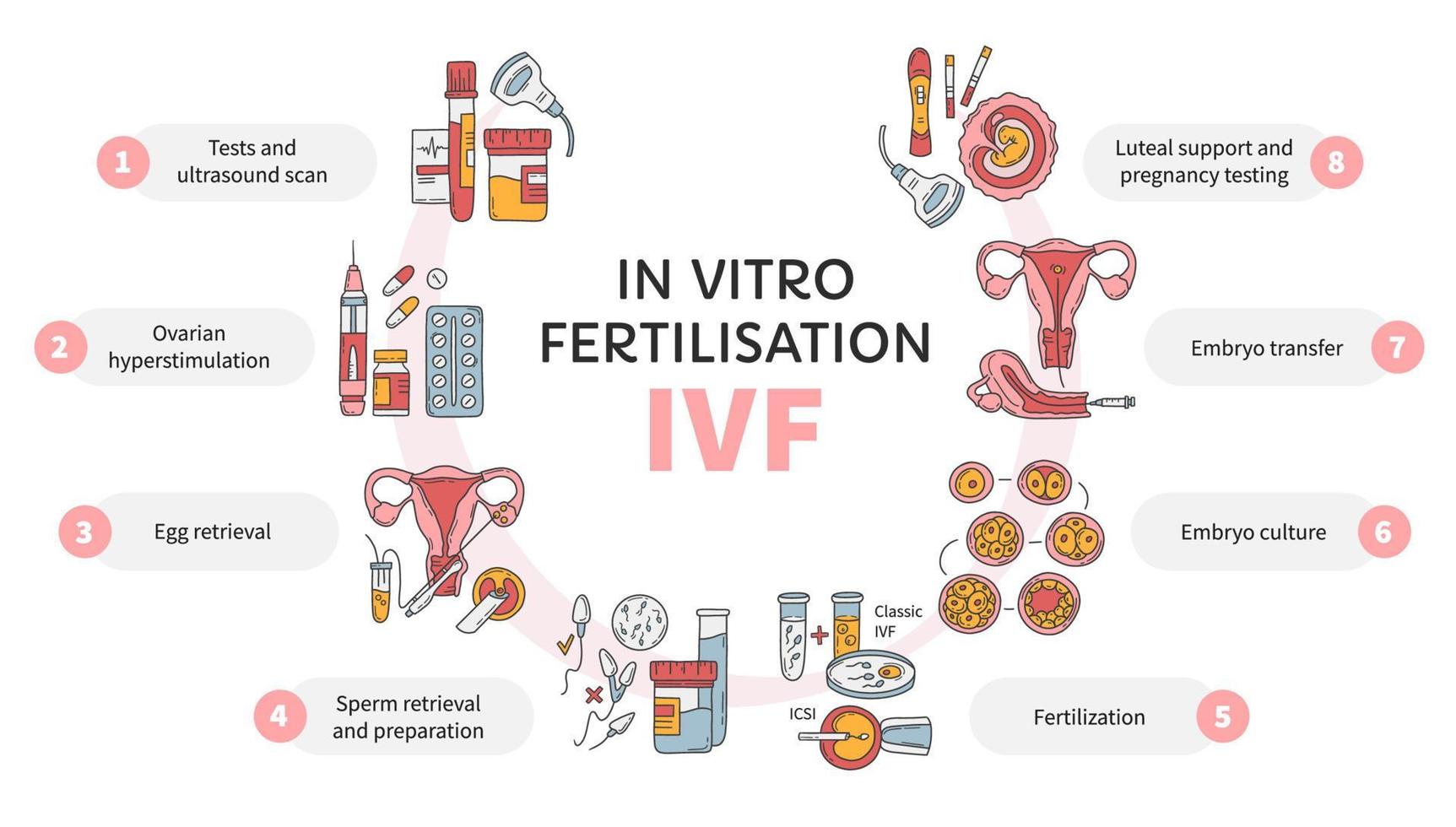 In Vitro fertilization IVF vector circle infographic, infertility treatment scheme. Ovarian hyperstimulation, artificial insemination, embryo culture, luteal support. Medical procedure for pregnancy