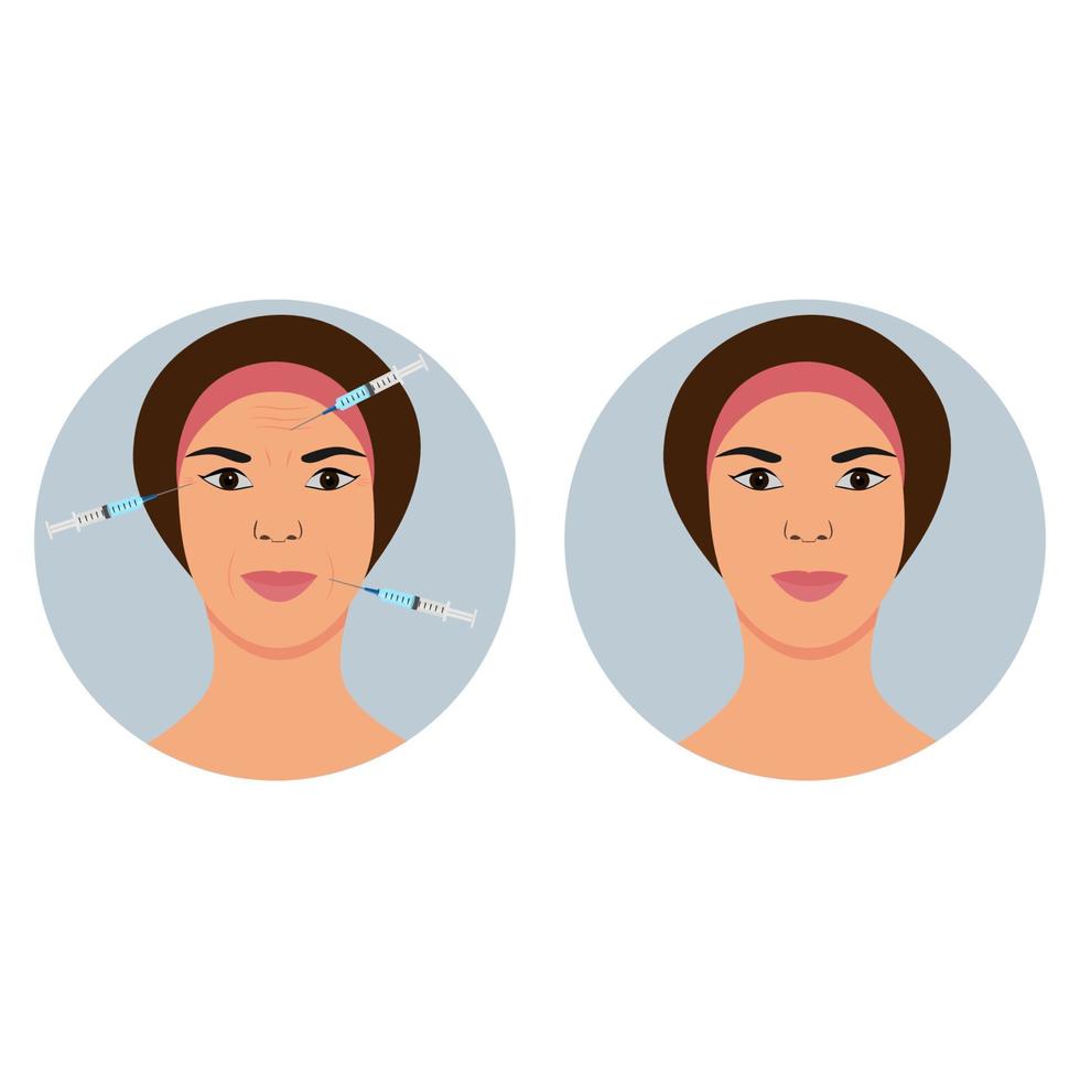 Facial injections against wrinkles and aging.Before and after.Beauty, cosmetology, anti-aging concept. Female rejuvenating mesotherapy.Vector illustration vector