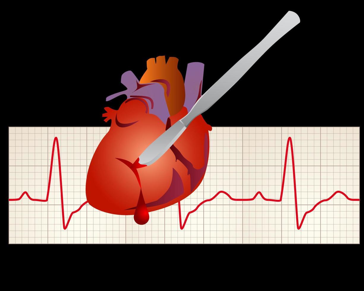 Heart with the cardiogram with a cutting scalpel vector