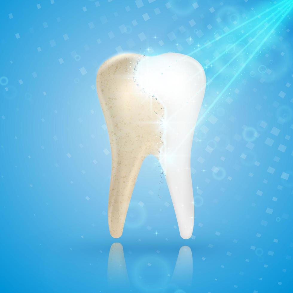 Teeth whitening 3d concept. Comparison of clean and dirty tooth before and after whitening treatment. vector