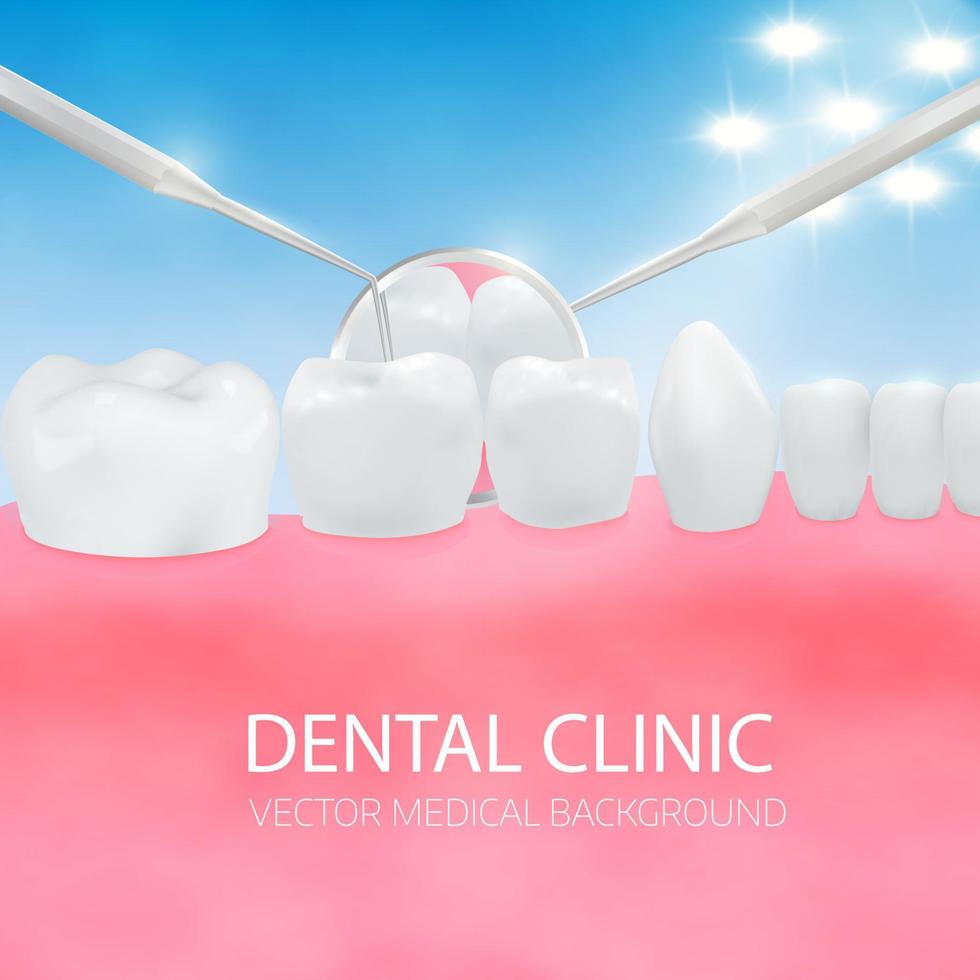 Dentists diagnostic. Oral cavity with white teeth  gum and dental equipment vector