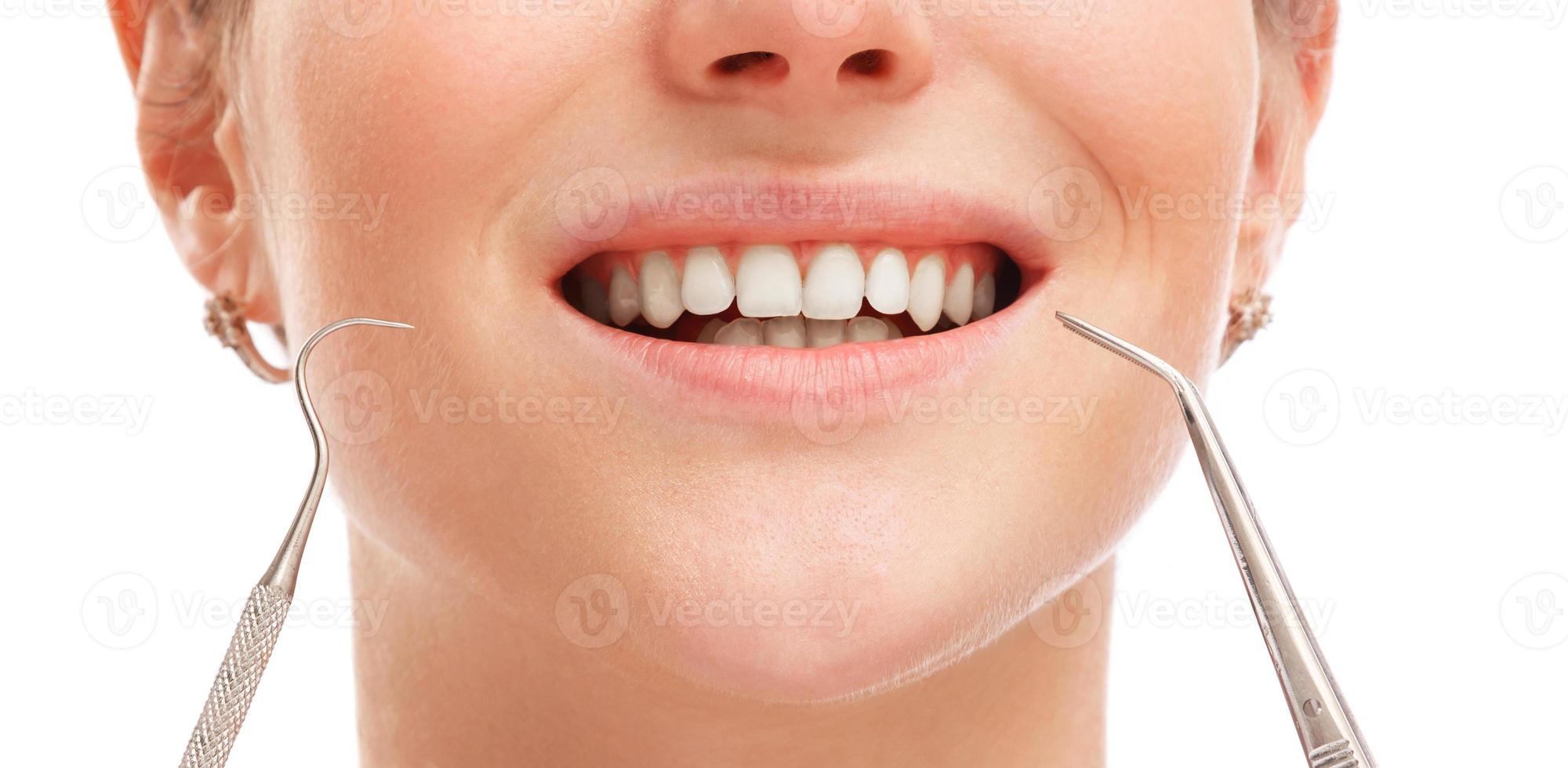 Female mouth with white teeth photo