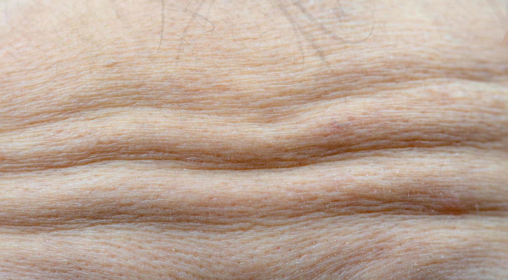 macro tiro detalle de las arrugas de la frente de la expresión emocional. concepto de inyecciones faciales de colágeno y botox. frente seca de la piel de la cara de la mujer menopáusica foto