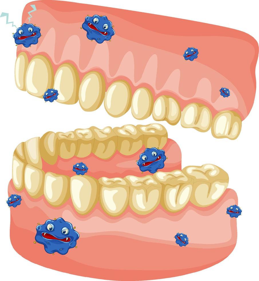 modelo de dientes humanos amarillos con bacterias vector