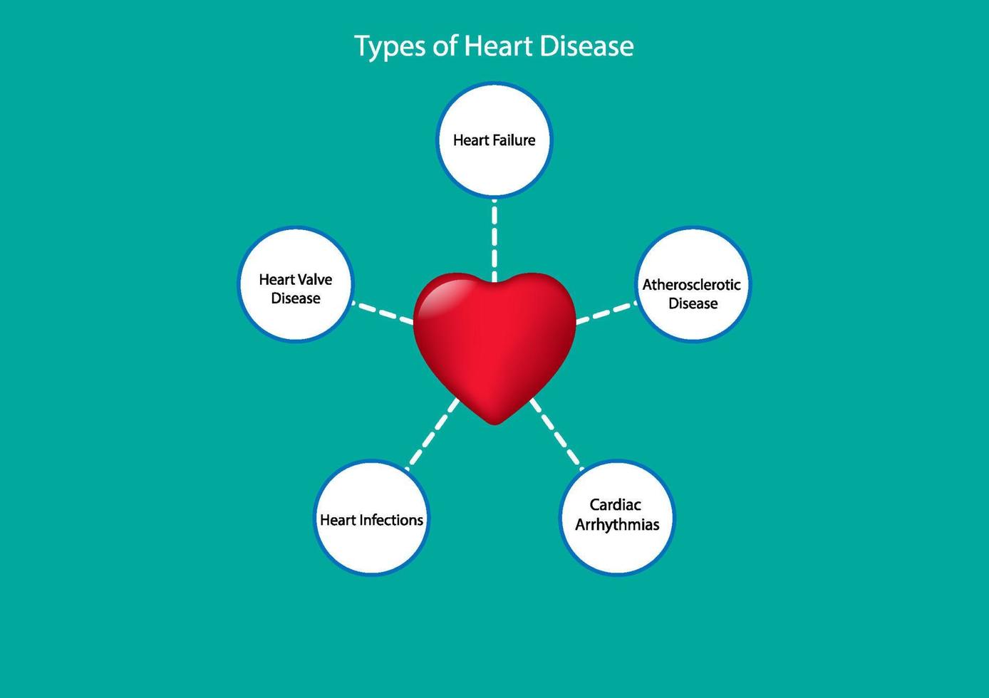 graphics drawing art, concept Goals by TYPE How Heart Disease Is Treated for Presentation vector illustration