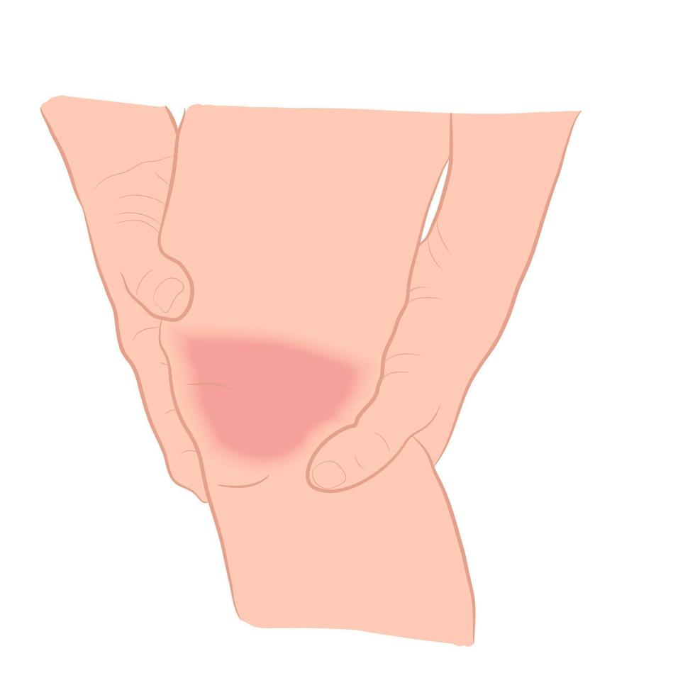 problemas de la articulación de la rodilla del hueso del tendón de la imagen gráfica en la ilustración del vector de la pierna