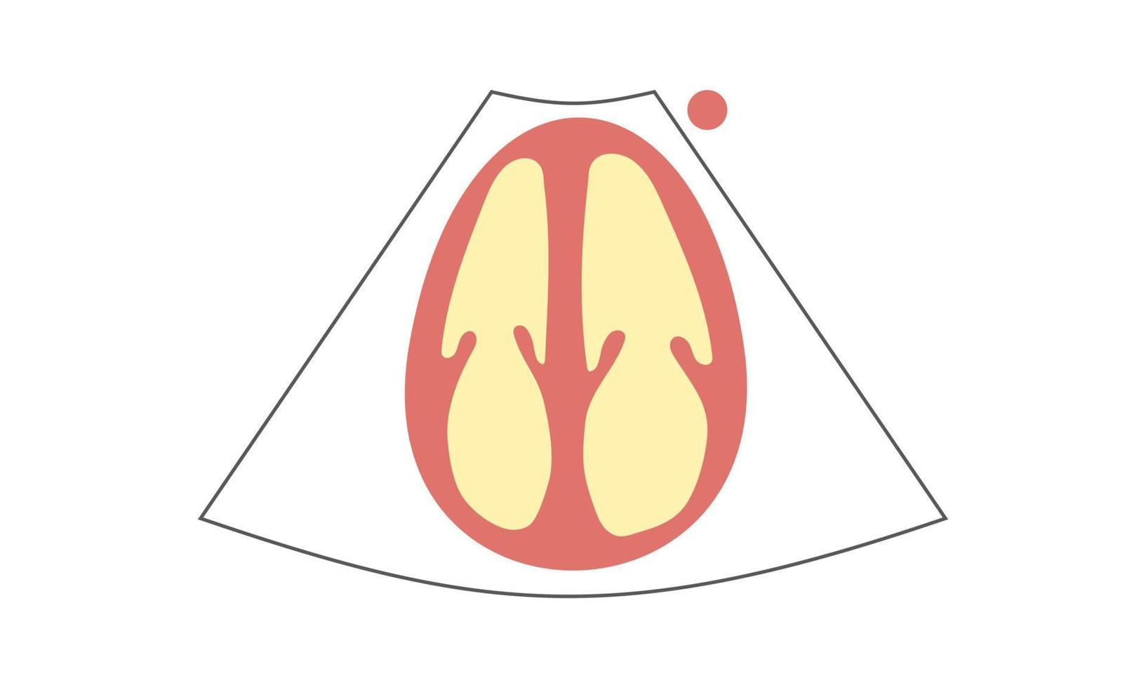 Diagram of Apical 4-Chamber View of Echocardiography. Healthcare Concept vector