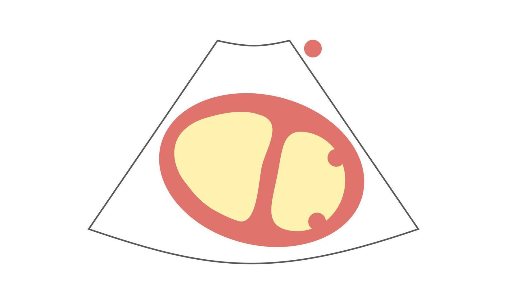 Diagram of right Ventricle D Shape of Parasternal Short Axis View at Papillary Muscle of Echocardiography. Healthcare Concept vector