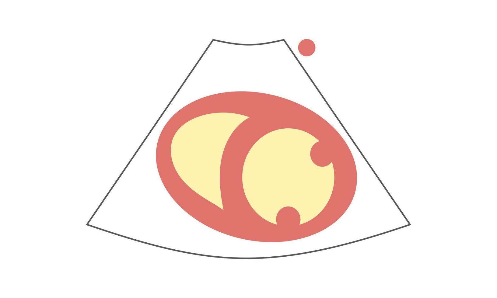 diagrama de la vista del eje corto paraesternal en la válvula mitral de la ecocardiografía. concepto de salud vector